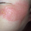 Step 2 - 滋潤修復濕疹霜（母嬰配方） (*EXP: 21/7/2024*) Eczema Therapy Cream （Mother & Baby Formula）50ml