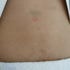 Step 1 - 濕疹抗敏急救修復油(母嬰配方) Eczema Therapy Oil (Mother & Baby Formula) 15ml