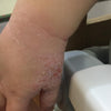 Step 2 - 滋潤修復濕疹霜(母嬰配方)Eczema Therapy Botanical Cream (Mother & Baby Formula)50m/100ml