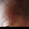 Step 2 - 滋潤修復濕疹霜(母嬰配方)Eczema Therapy Botanical Cream (Mother & Baby Formula)50m/100ml