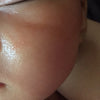 Step 1 - 濕疹抗敏急救修復油（母嬰配方） Eczema Therapy Oil  (Mother & Baby Formula) 15ml