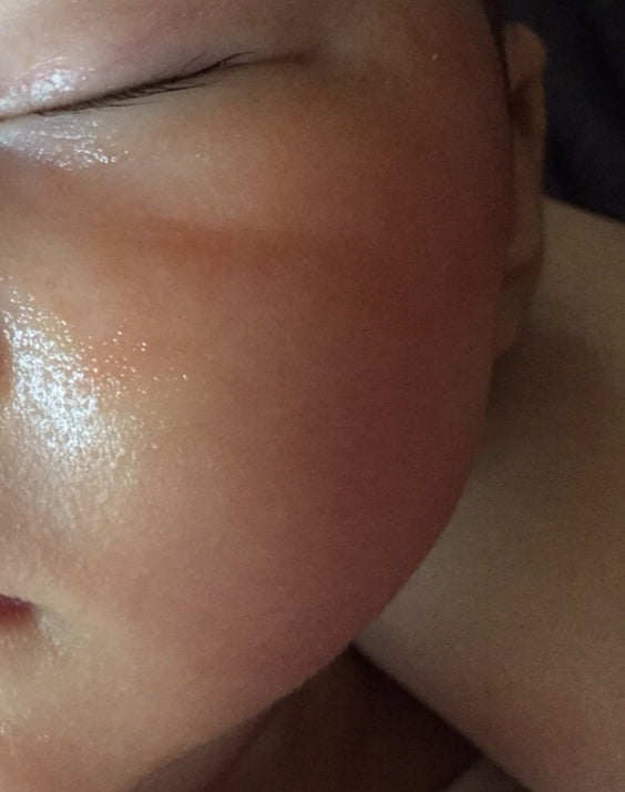 Step 2 - 滋潤修復濕疹霜（母嬰配方）Eczema Therapy Botanical Cream （Mother & Baby Formula）50m/100ml