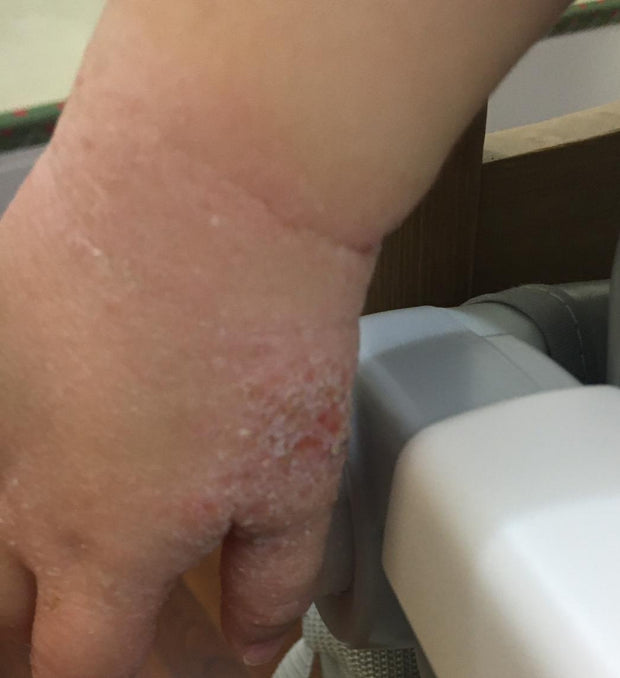 Step 2 - 滋潤修復濕疹霜（母嬰配方）Eczema Therapy Botanical Cream （Mother & Baby Formula）50m/100ml