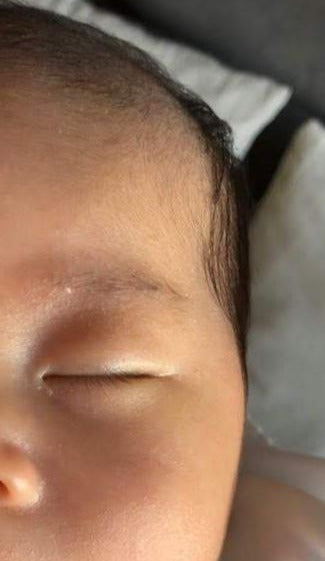 Step 2 - 滋潤修復濕疹霜（母嬰配方）Eczema Therapy Botanical Cream （Mother & Baby Formula）50m/100ml